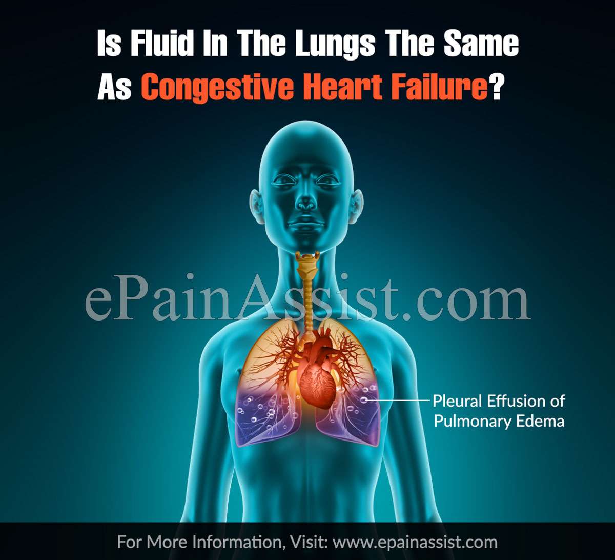 Is Fluid In The Lungs The Same As Congestive Heart Failure?