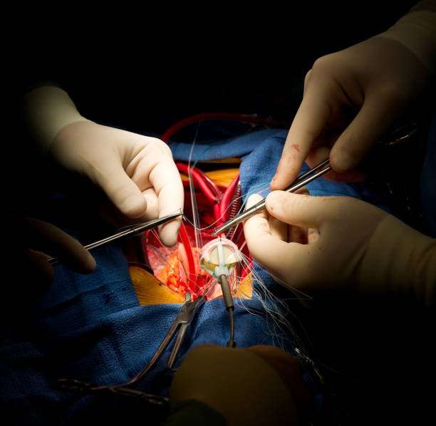 Is Valve Replacement Surgery Open Heart Surgery