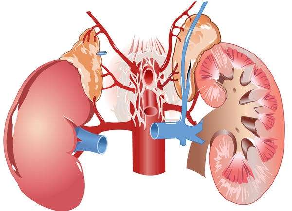 Kidney Dialysis And Congestive heart Failure