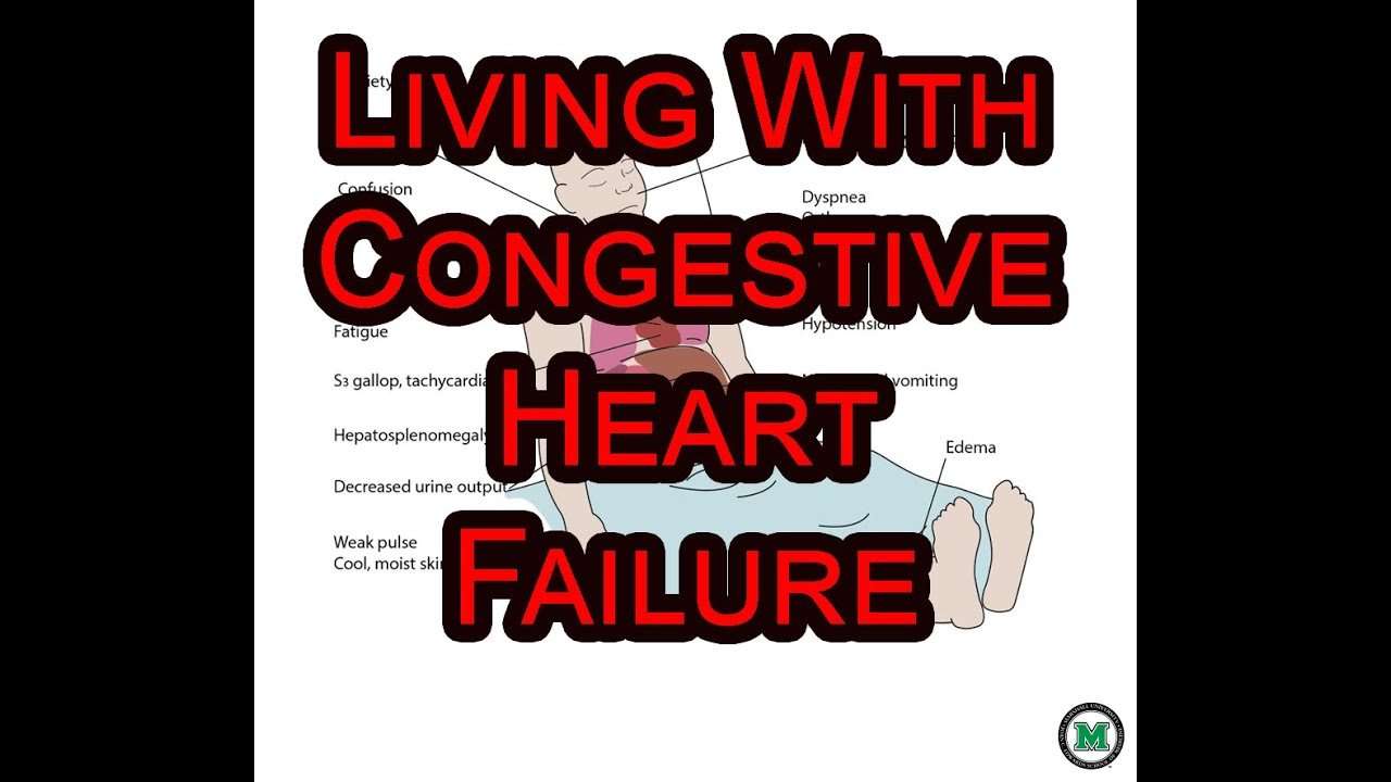 Living With Congestive Heart Failure