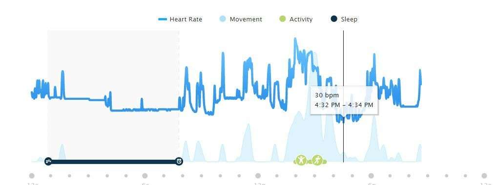 Low resting heart rate (too low?)