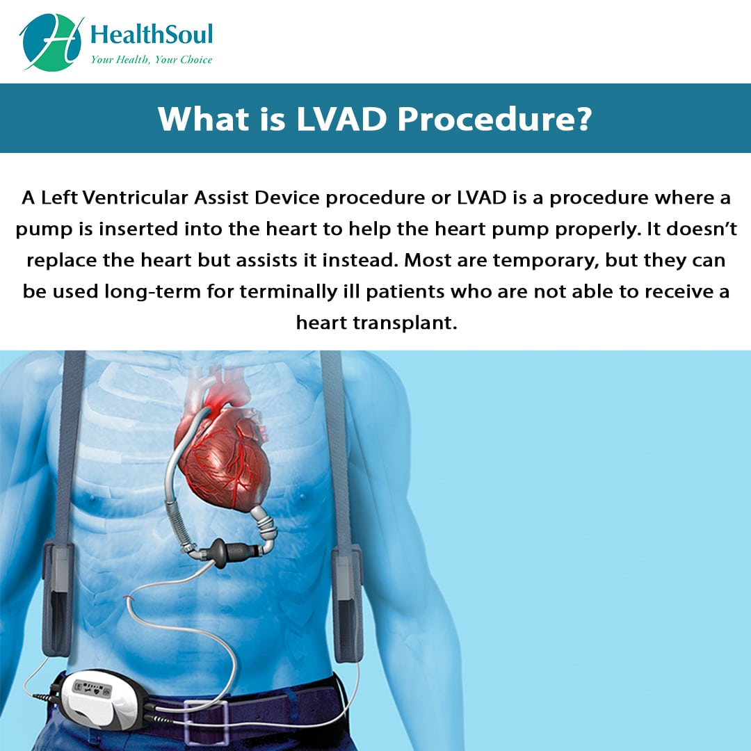 LVAD Procedure