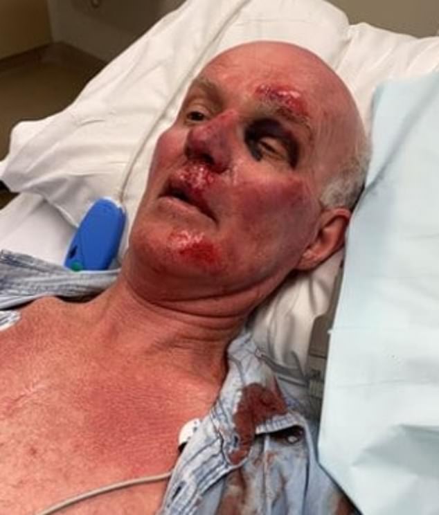 Man, 67, recovering from open heart surgery is left a bloodied mess ...