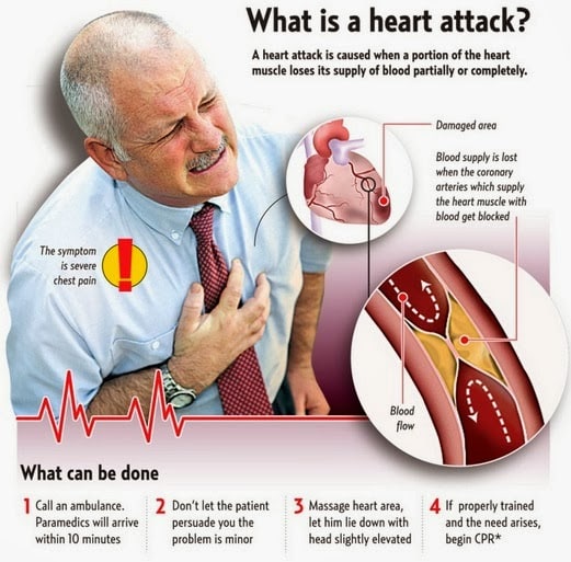 Non Invasive Heart Care: GET TO KNOW ABOUT HEART ATTACK