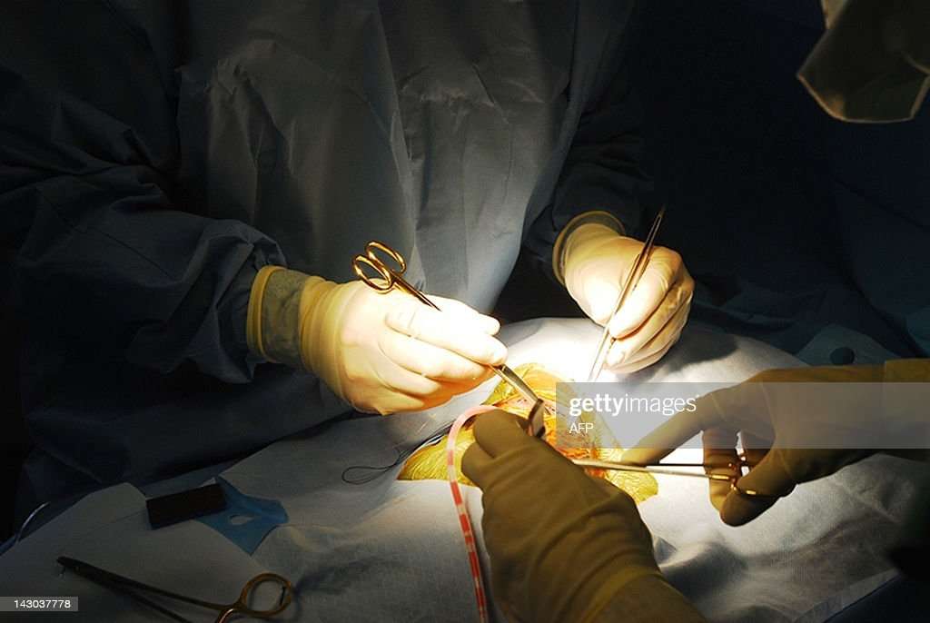 Open heart surgery is performed by a team of French and ...