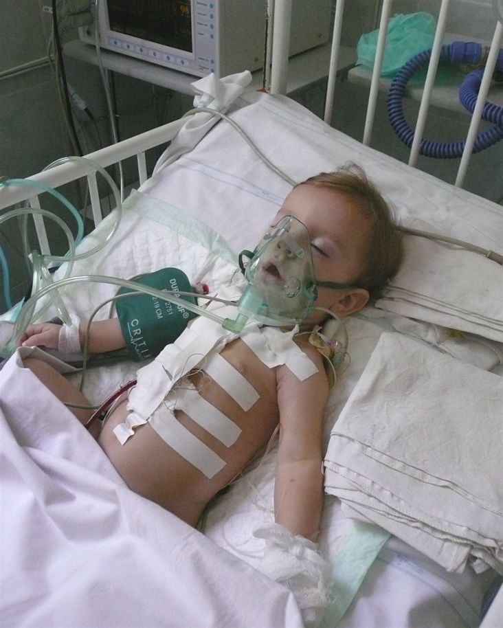 Recovering from open heart surgery (With images)