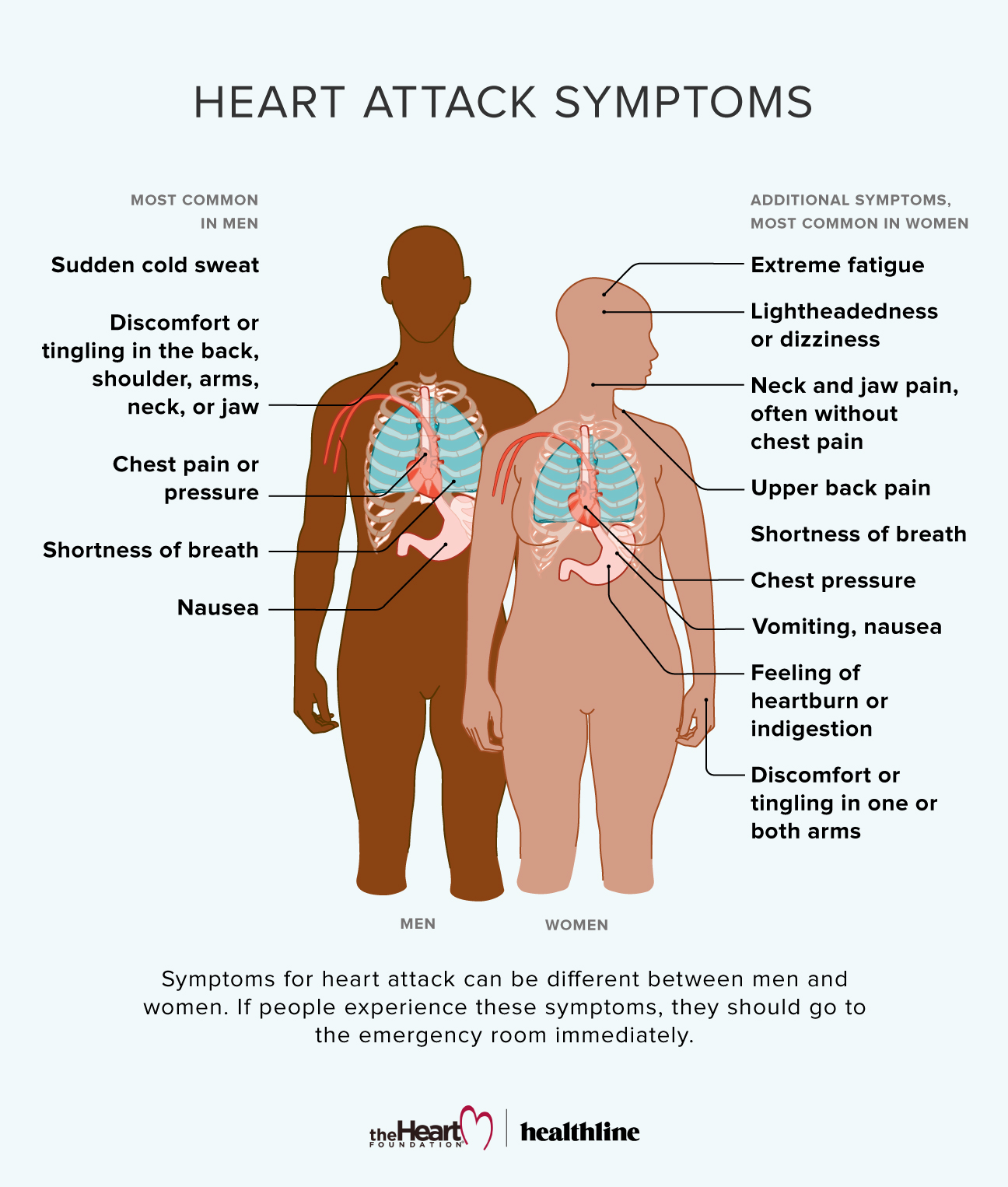 Signs and Symptoms of Heart Attack in Women