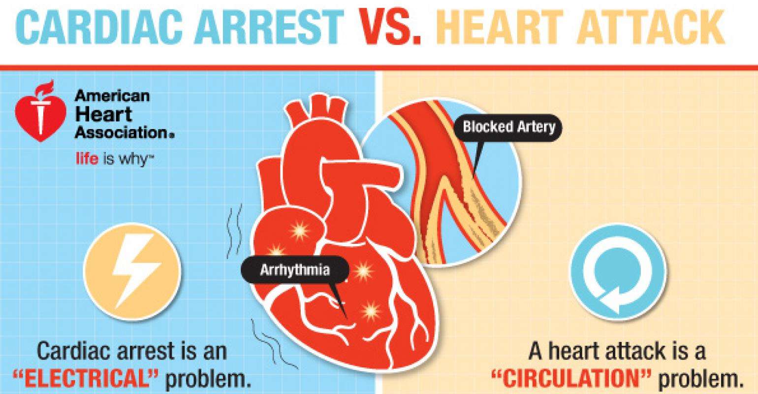 Sudden Cardiac Arrest and Heart Attack: What