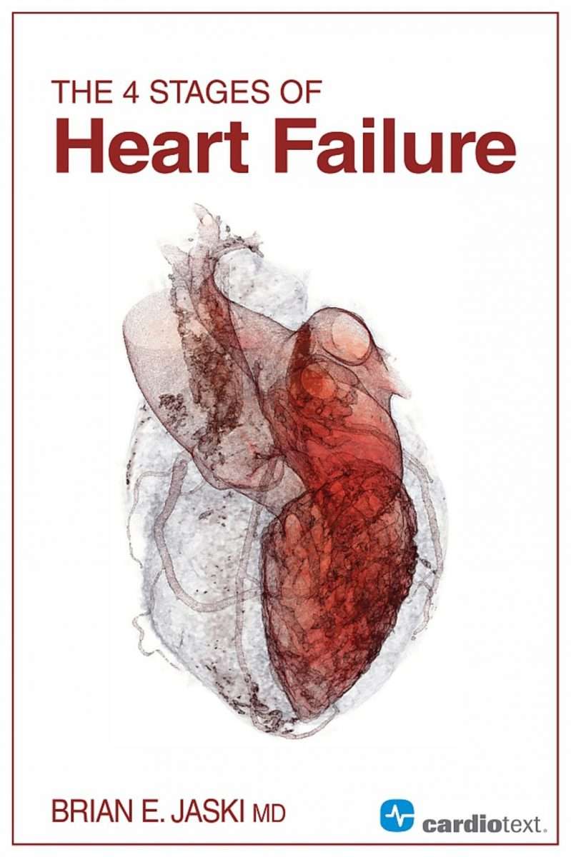 The 4 Stages of Heart Failure (eBook) (With images)