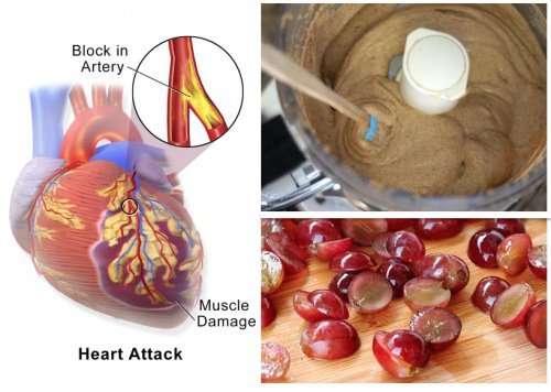 The diet plan of heart attack patients must be revamped to ...