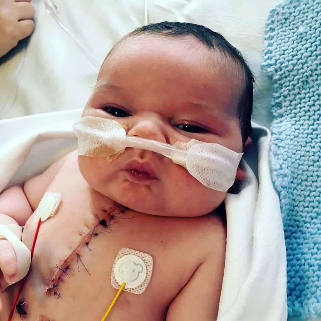 Tiny tot with half a HEART allowed to go home after surviving open ...