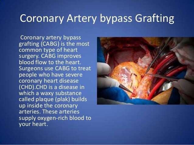 Types of Open Heart Surgery