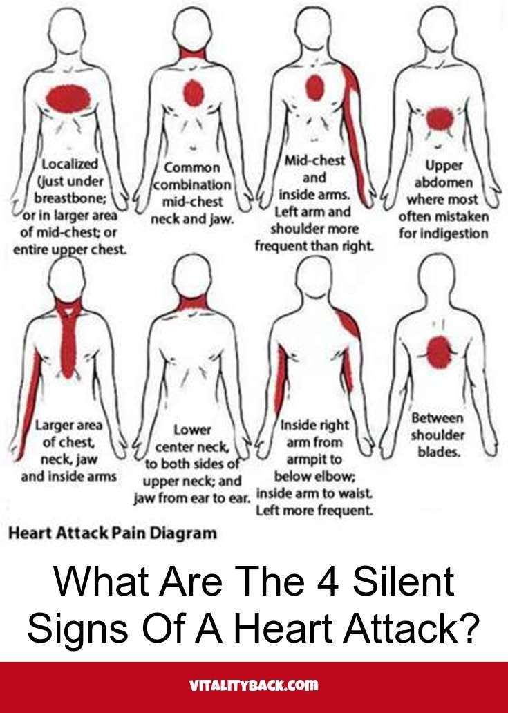 What are the 4 silent signs of a heart attack? Simply click here to ...