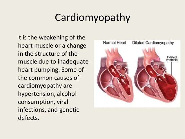 What Are The Different Forms Of Cardiovascular Disease