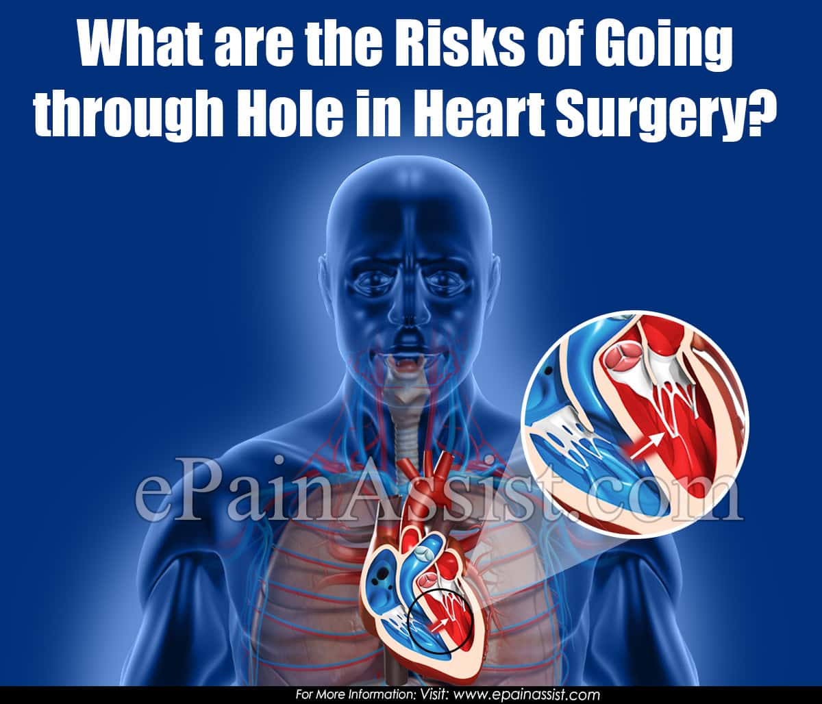 What are the Risks of Going through Hole in Heart Surgery?