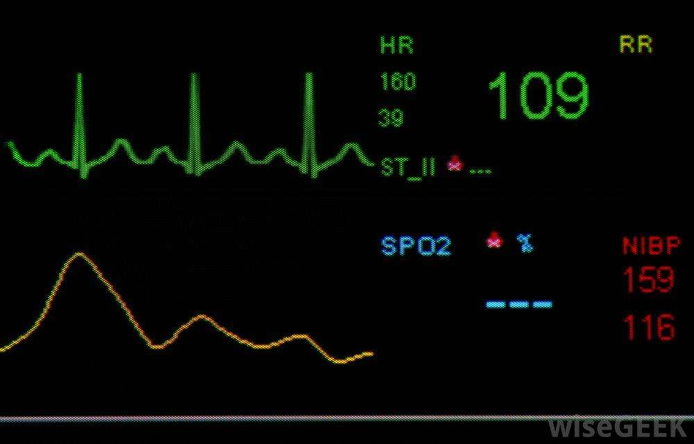 What Is Considered a Normal Heart Rate? (with pictures)