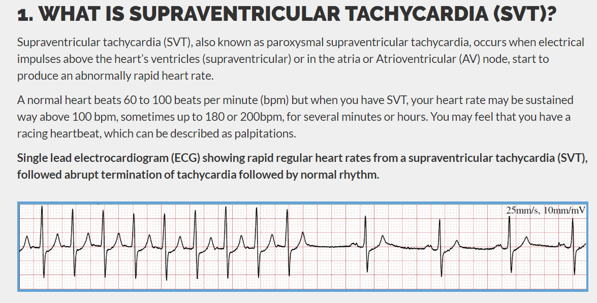 WHAT IS SUPRAVENTRICULAR TACHYCARDIA (SVT)?