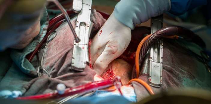 What is the difference between Bypass and Open Heart Surgery ...