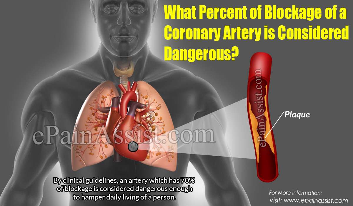 What Percent of Blockage of a Coronary Artery is ...