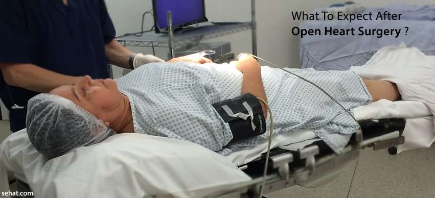 What To Expect After Open Heart Surgery?