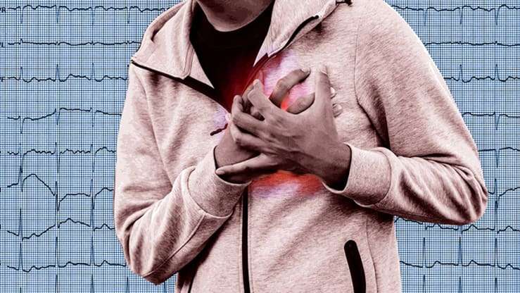 Why Healthy Young People Have Heart Attacks