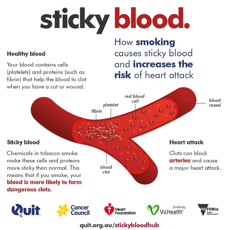 Why to quit smoking: Heart attacks caused by âsticky bloodâ