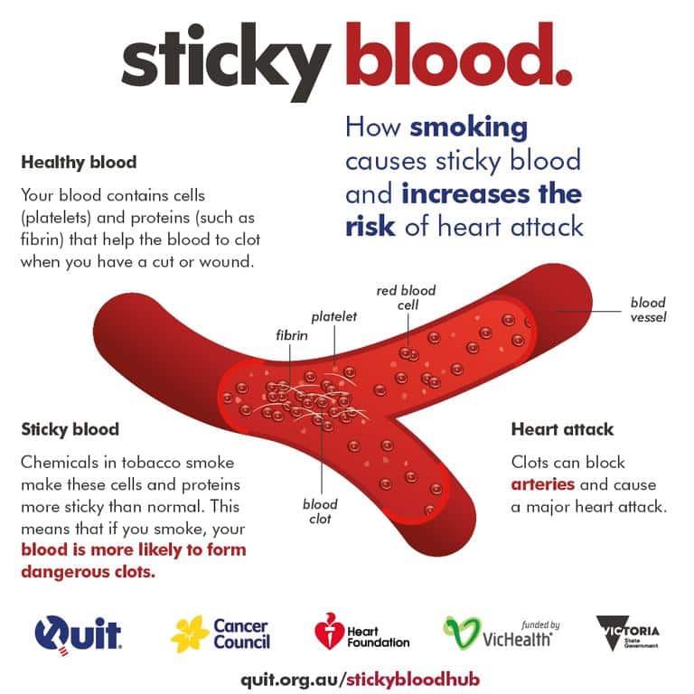 Why to quit smoking: Heart attacks caused by sticky blood